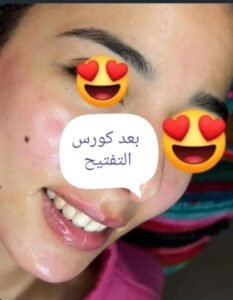 whatsapp image 2025 11 13 at 16.56.04 bcc2ae7c