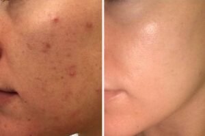 whatsapp image 2025 11 15 at 15.22.41 d5f4eb64