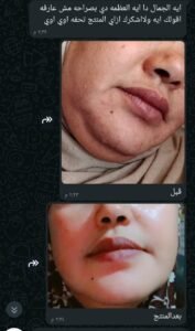 صورة واتساب بتاريخ 1447 05 28 في 20.03.49 974e8e7a