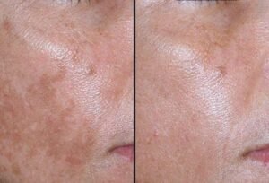 صورة واتساب بتاريخ 1447 05 28 في 20.03.50 4327a843