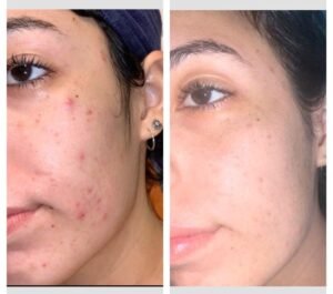 صورة واتساب بتاريخ 1447 05 28 في 20.03.54 32d7030c