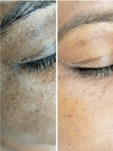 صورة واتساب بتاريخ 1447 05 28 في 20.03.54 5e22aa47