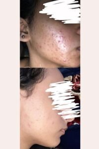 صورة واتساب بتاريخ 1447 05 28 في 20.03.54 62a57084