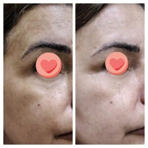 صورة واتساب بتاريخ 1447 05 28 في 20.03.55 a27aa2f0