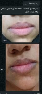 صورة واتساب بتاريخ 1447 05 28 في 20.23.14 af2bd03b