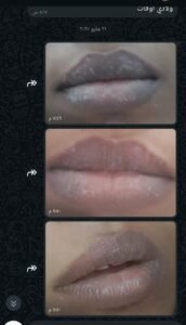 صورة واتساب بتاريخ 1447 05 28 في 20.23.34 916fa597