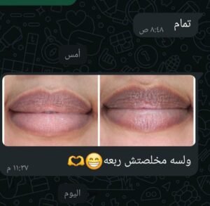 صورة واتساب بتاريخ 1447 05 28 في 20.23.35 2314443e