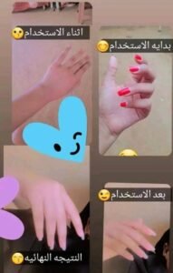 صورة واتساب بتاريخ 1447 05 28 في 20.28.33 a68f8219