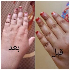 صورة واتساب بتاريخ 1447 05 28 في 20.28.42 7cb572ab