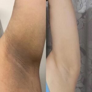 صورة واتساب بتاريخ 1447 05 28 في 20.28.50 346e2a4a