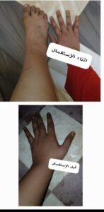 صورة واتساب بتاريخ 1447 05 28 في 20.30.10 0a87e2d4