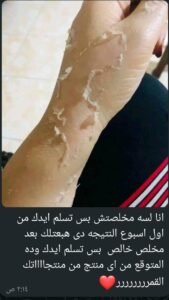 صورة واتساب بتاريخ 1447 05 28 في 20.30.32 5f6ffb62